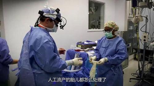 医院爆料小孩流产视频,小孩流产视频引发社会关注 第3张 医院爆料小孩流产视频,小孩流产视频引发社会关注 第3张